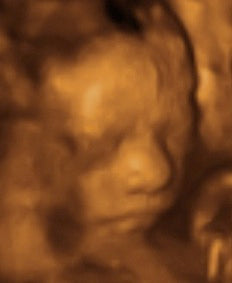 Pregnancy Week image