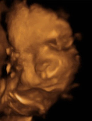 Pregnancy Week image