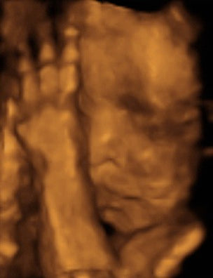 Pregnancy Week image