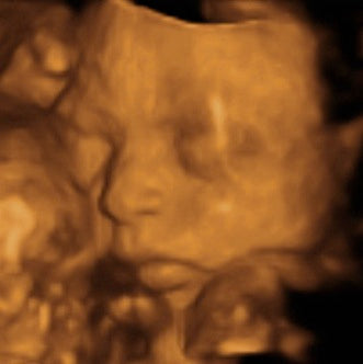 Pregnancy Week image