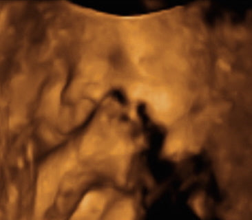 Pregnancy Week image