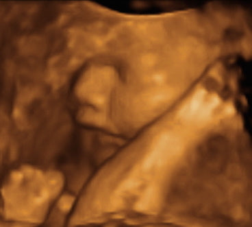 Pregnancy Week image