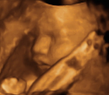 Pregnancy Week image