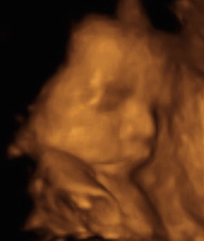 Pregnancy Week image