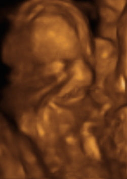 Pregnancy Week image