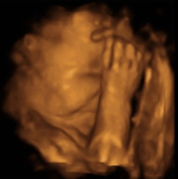 Pregnancy Week image