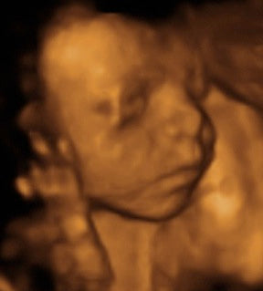Pregnancy Week image
