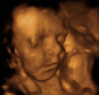 Pregnancy Week image