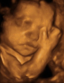 Pregnancy Week image