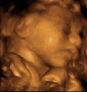 Pregnancy Week image
