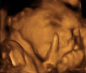 Pregnancy Week image