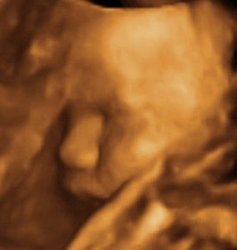 Pregnancy Week image