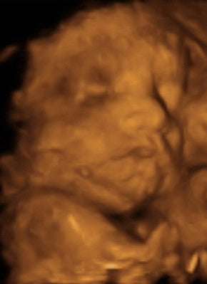 Pregnancy Week image