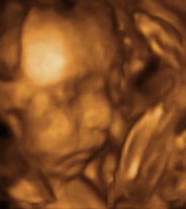 Pregnancy Week image