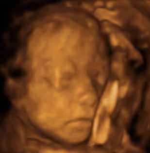 Pregnancy Week image