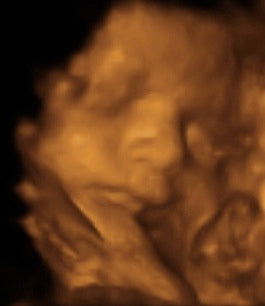 Pregnancy Week image