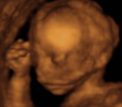 Pregnancy Week image