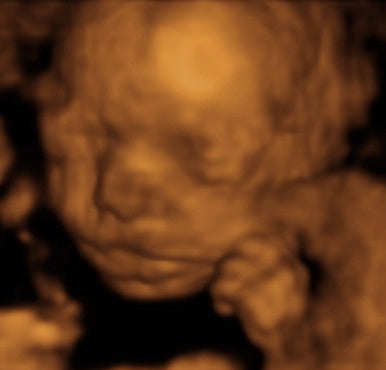 Pregnancy Week image