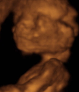 Pregnancy Week image