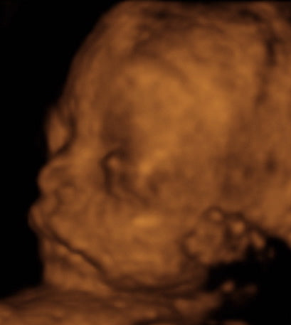 Pregnancy Week image