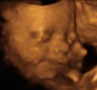 Pregnancy Week image