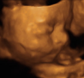 Pregnancy Week image
