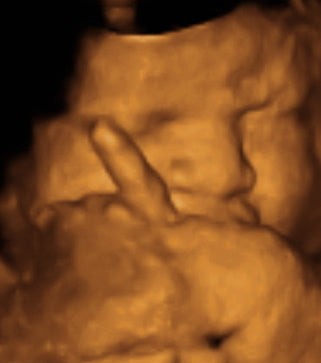 Pregnancy Week image