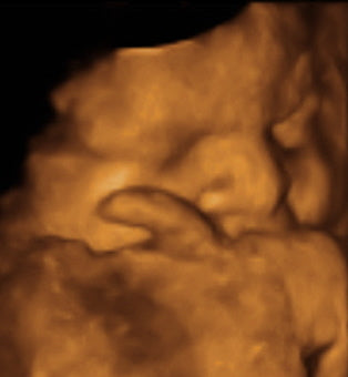 Pregnancy Week image