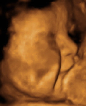 Pregnancy Week image