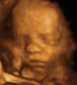 Pregnancy Week image