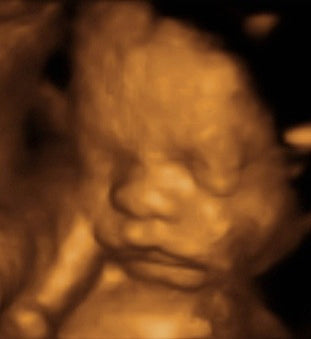 Pregnancy Week image