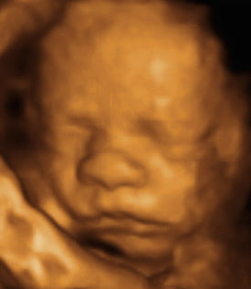Pregnancy Week image