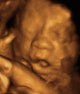 Pregnancy Week image