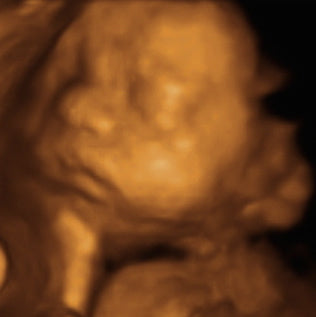 Pregnancy Week image