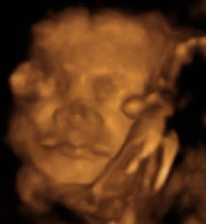 Pregnancy Week image