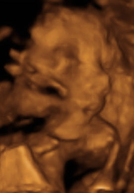 Pregnancy Week image
