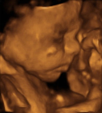 Pregnancy Week image