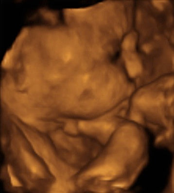 Pregnancy Week image