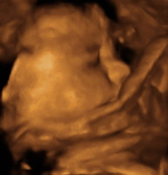 Pregnancy Week image