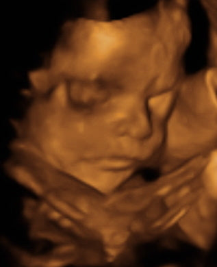 Pregnancy Week image