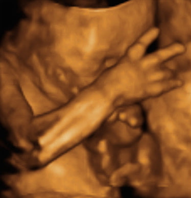 Pregnancy Week image