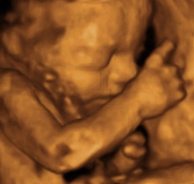 Pregnancy Week image