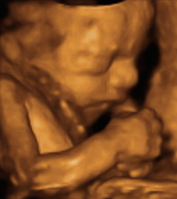 Pregnancy Week image