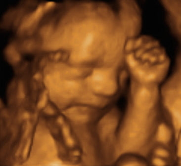 Pregnancy Week image