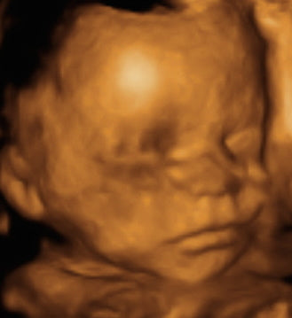 Pregnancy Week image