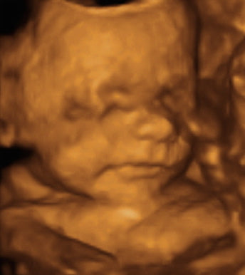 Pregnancy Week image