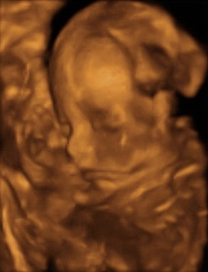 Pregnancy Week image