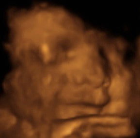 Pregnancy Week image