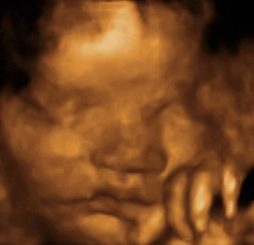 Pregnancy Week image