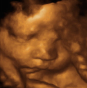 Pregnancy Week image